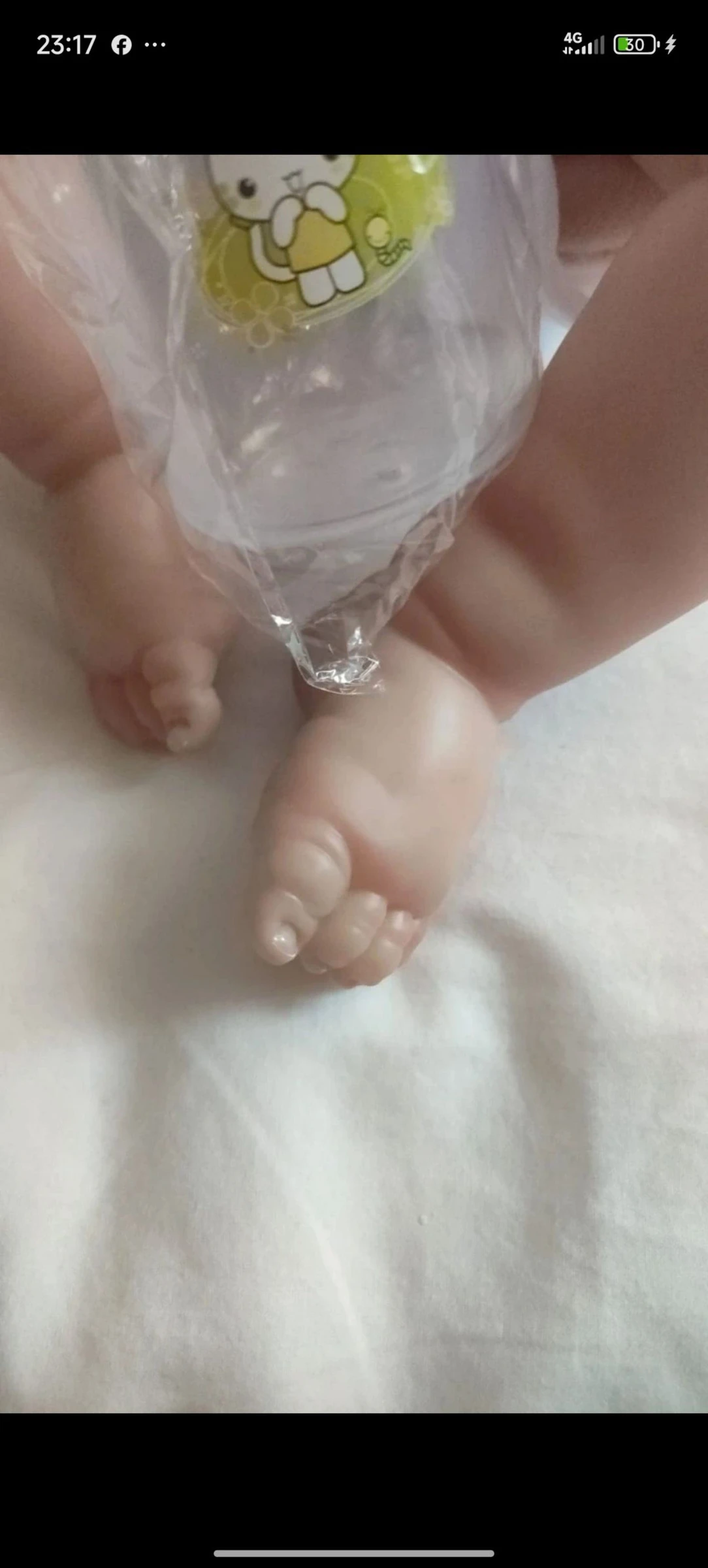 Bebe réanimé – photo 5